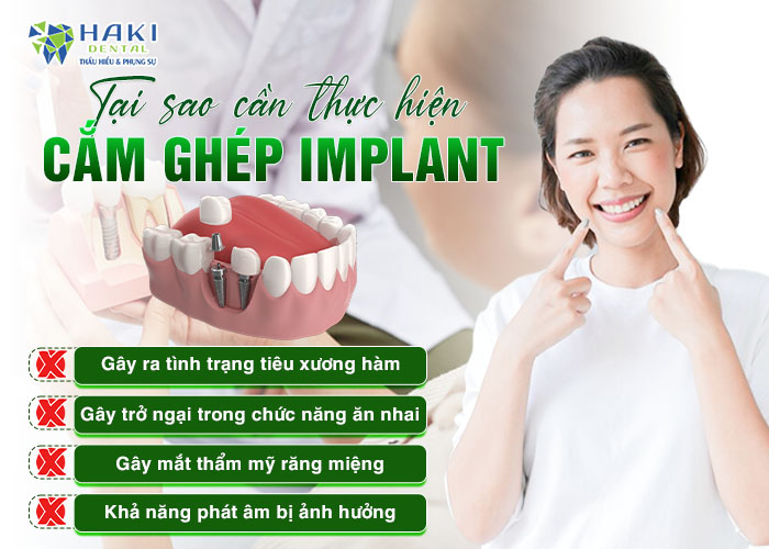 
Tai sao can phai cam ghep Implant