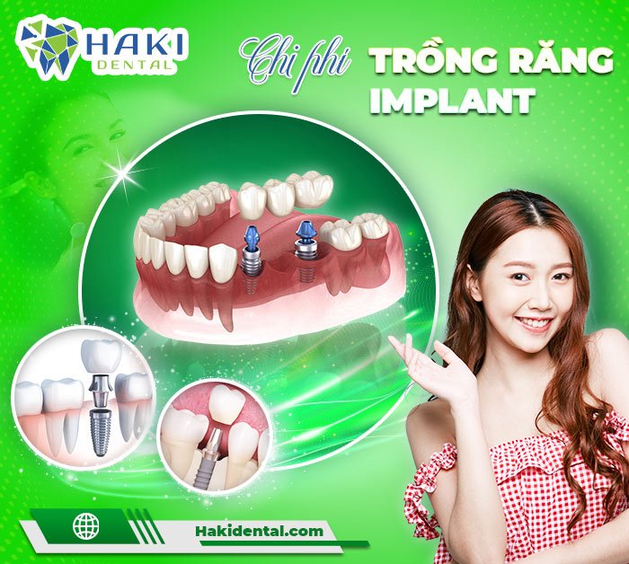 Chi phi trong rang Implant tai Haki Dental