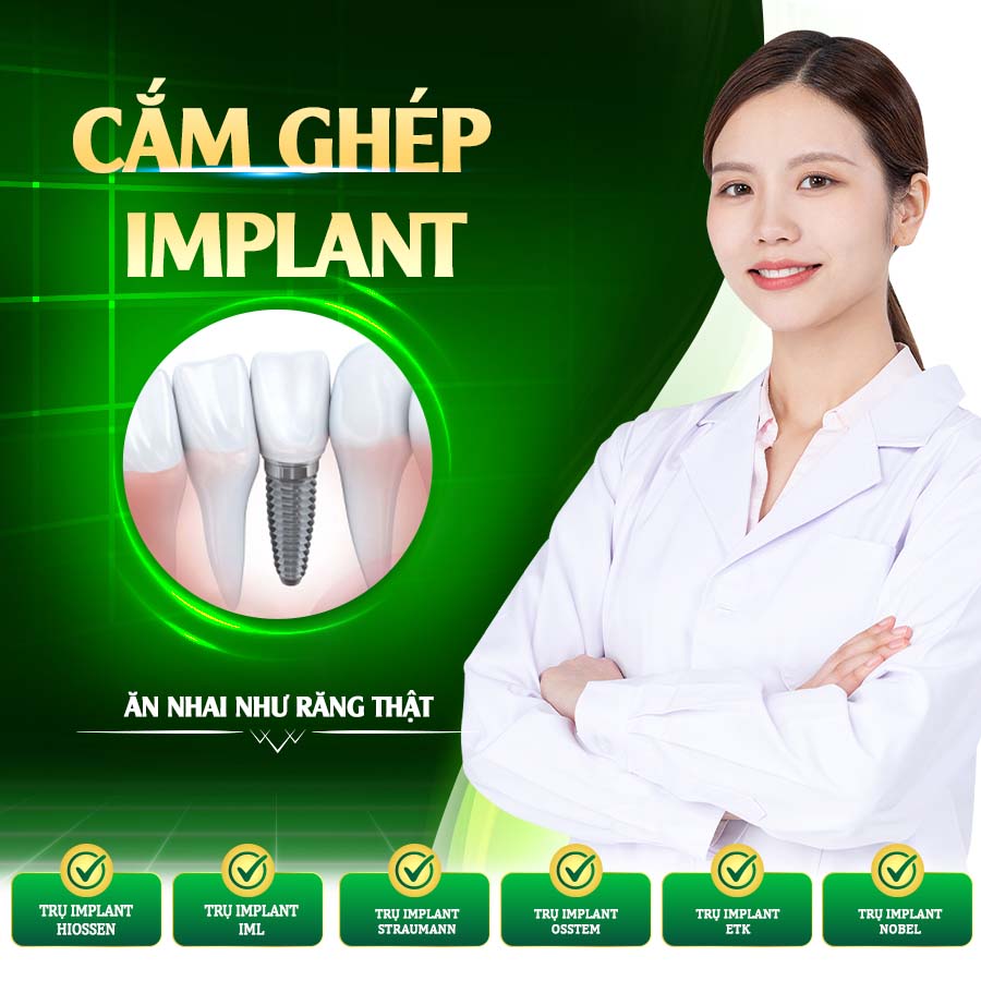 Cam ghep Implant